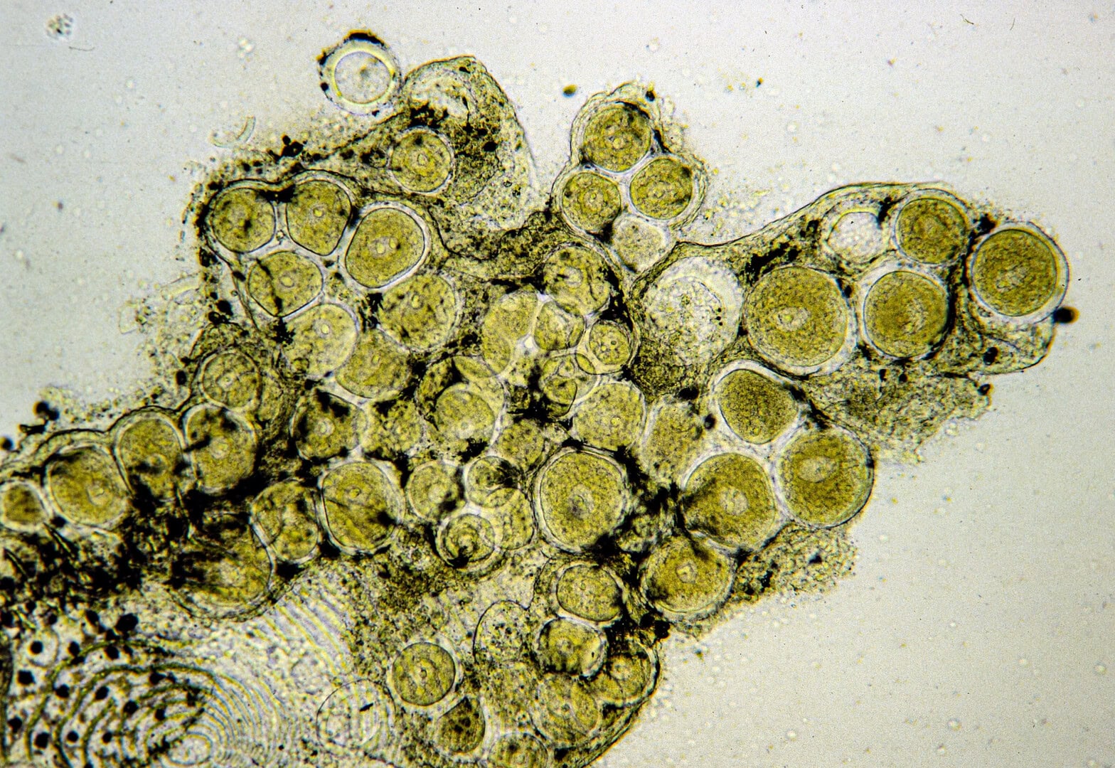 AQ2025 04 173 Lymphocystis 10 Hautabstrich mit Lymphocystis-Zysten, Vergr.: 63x. Foto: Dieter Untergasser