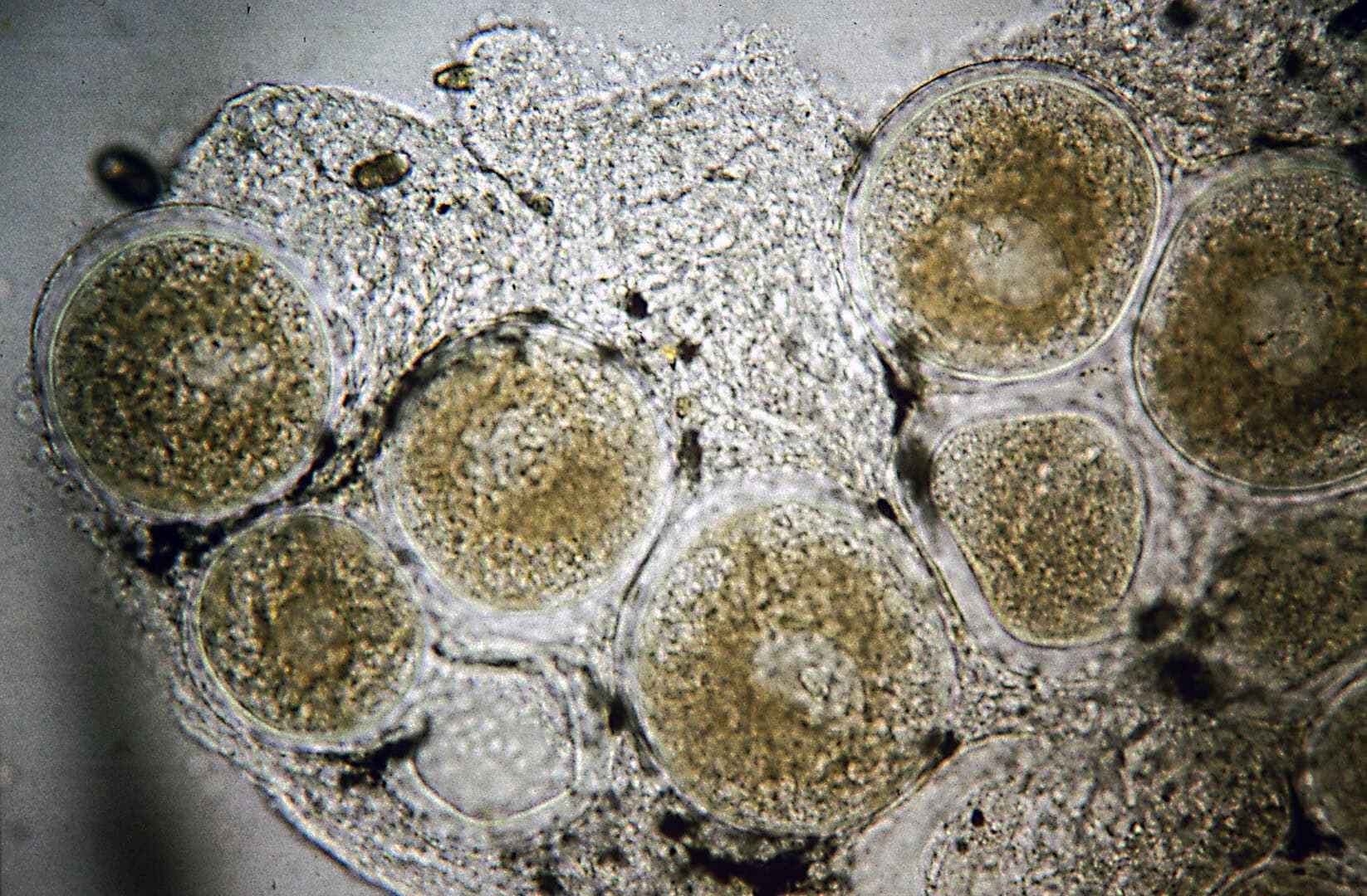 AQ2025 04 173 Lymphocystis 11 Die Lymphocystis-Zysten haben keinen Zellkern, Vergr.: 200x. Foto: Dieter Untergasser