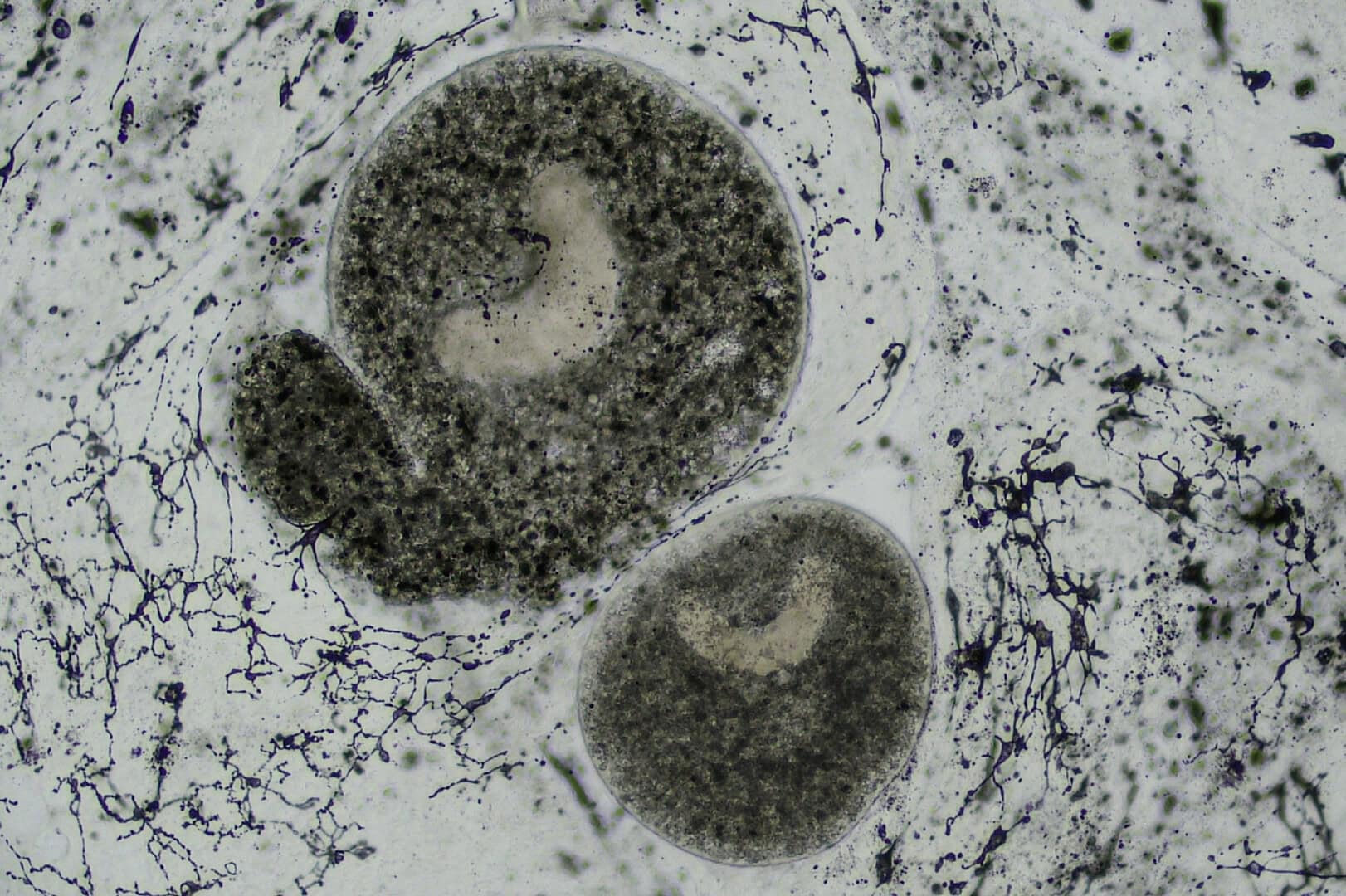 AQ2025 04 173 Lymphocystis 12 Bei Ichthyophthirius ist der Zellkern gut zu erkennen, Vergr.: 100x. Foto: Dieter Untergasser