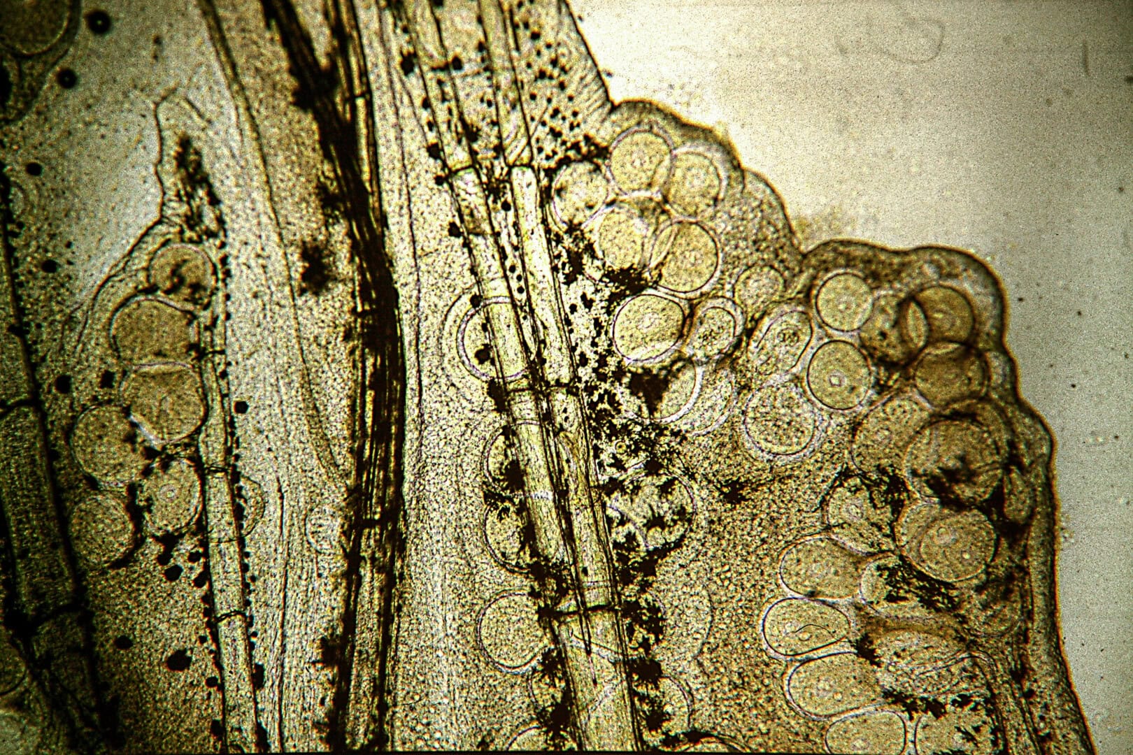 AQ2025 04 173 Lymphocystis 13 Die befallenen Zellen enthalten riesige Mengen von Viren, Vergr.: 40x. Foto: Dieter Untergasser