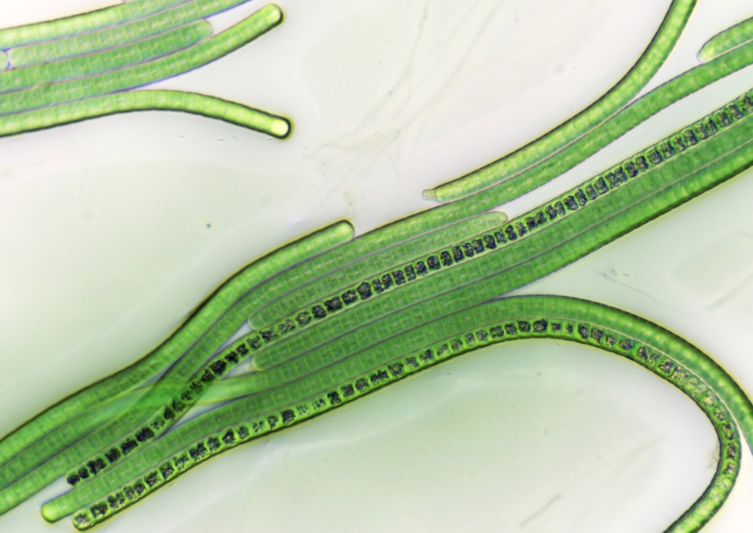 Blaualgen unter dem Mikroskop. Foto: Bresser